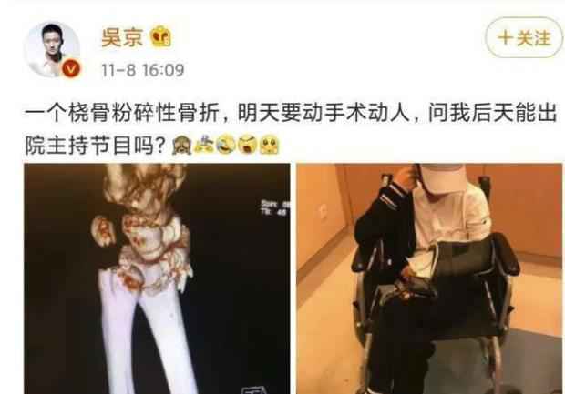 吴京曝谢楠骨折