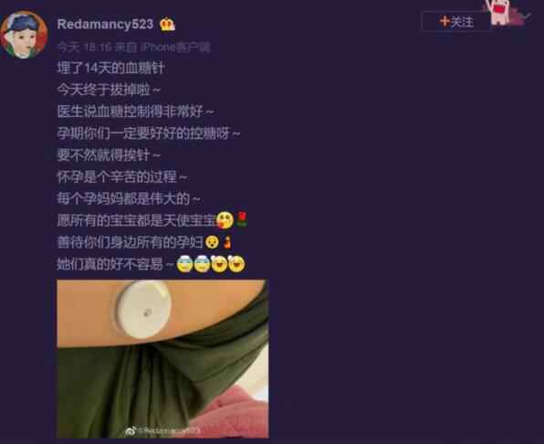 杜淳老婆孕期扎针